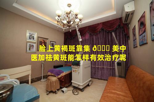 脸上黄褐斑靠集 🐋 美中医加祛黄斑能怎样有效治疗呢